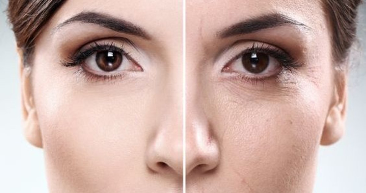 anti-aging-collagen-production