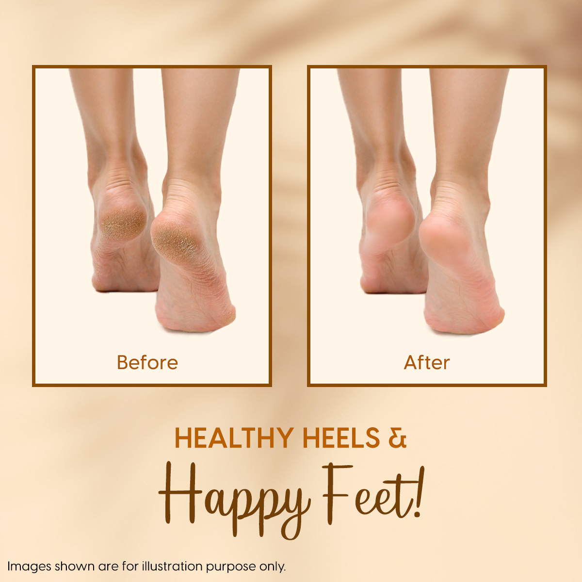 How To Treat Cracked Heels And Calluses With Himalayan Salt? – Life &  Pursuits
