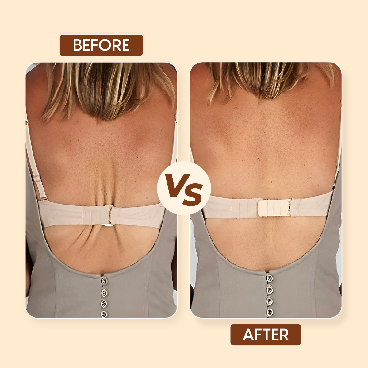 Matra Bra Extender Stretchable Elastic Extension Strap Adjustable Buckle 2 Hook 3 Eye Beige Black 2Pc - Image 3