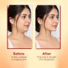 Matra Invisible Face Lifting Tape V-Shape Instant Makeup Wrinkle Patch for Neck Skin Double Chin - Image 5